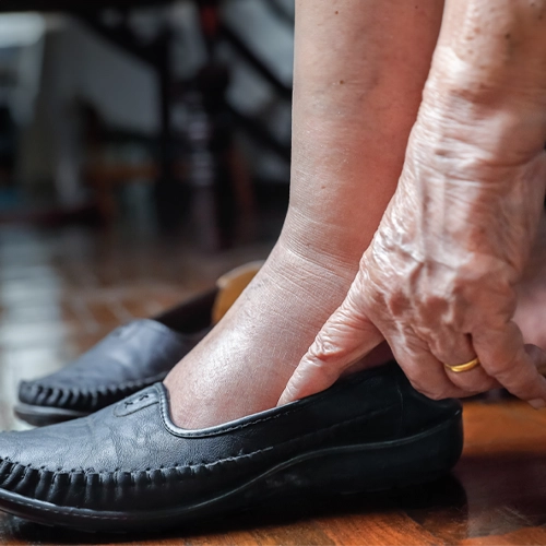 The feet and hands of an elderly person as they put on slip-on shoes.